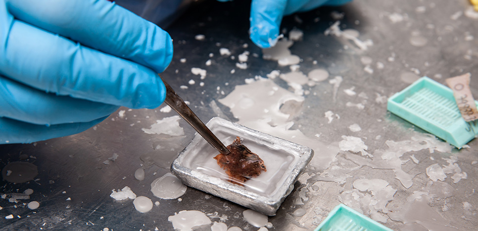 Making Metabolomics Work on FFPE Tissues