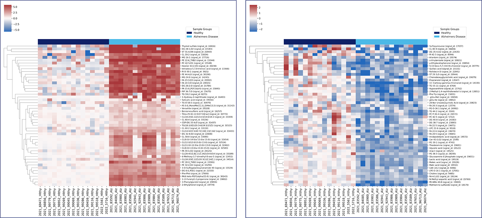 Heatmaps showing enriched and reduced metabolite clusters in Alzheimer’s patients, indicating widespread metabolic disruption