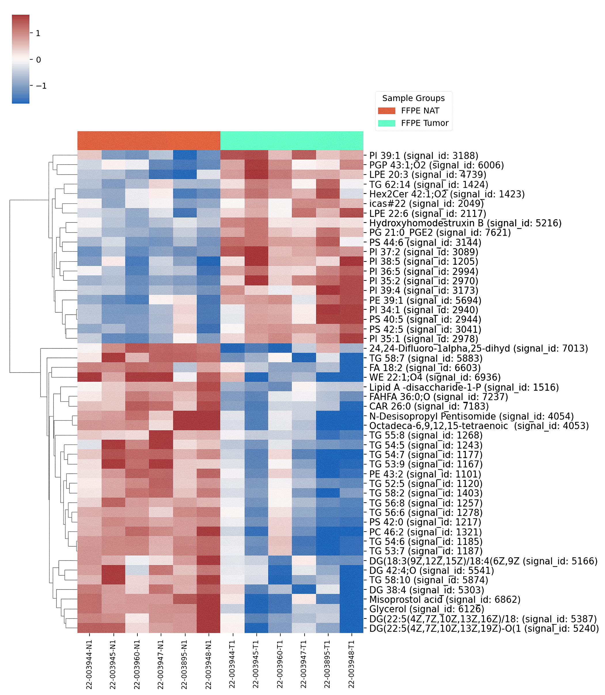 Heatmap of significantly altered metabolites comparing cancer and adjacent normal tissues using untargeted metabolomics.